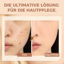 Laden Sie das Bild in den Galerie-Viewer, 🪞Concealer-Stift mit zwei Enden