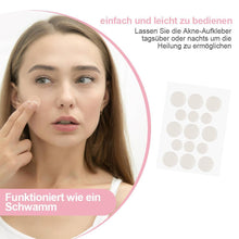 Laden Sie das Bild in den Galerie-Viewer, Aknen Aufkleber, 30 Stücke