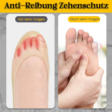 Laden Sie das Bild in den Galerie-Viewer, Anti-Reibungs-Zehenschutz aus Silikon