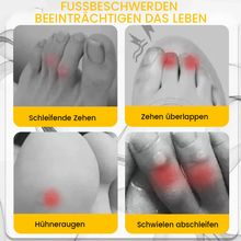Laden Sie das Bild in den Galerie-Viewer, Anti-Reibungs-Zehenschutz aus Silikon